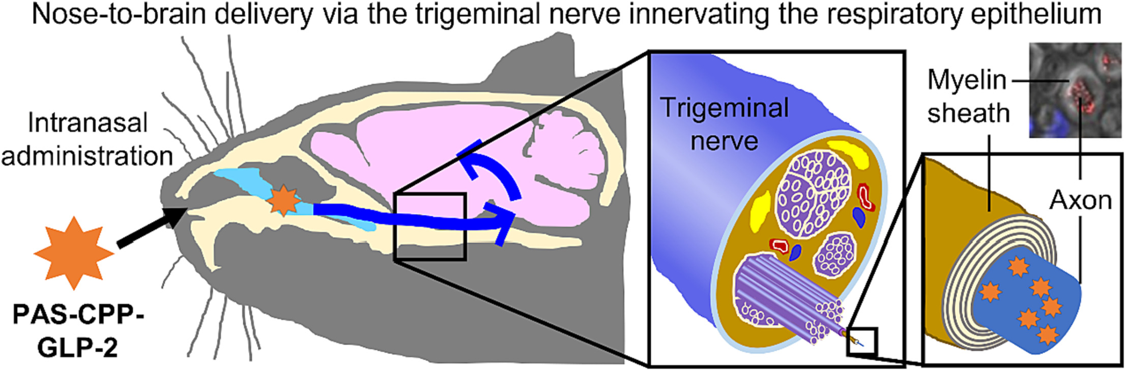 The Nose-Brain Pathway: