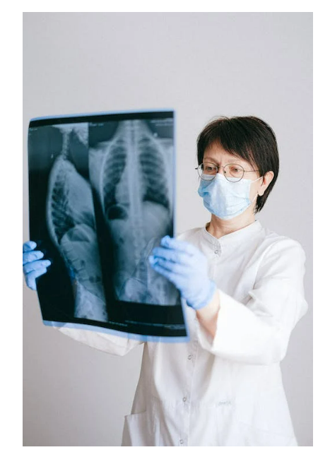 chest xray